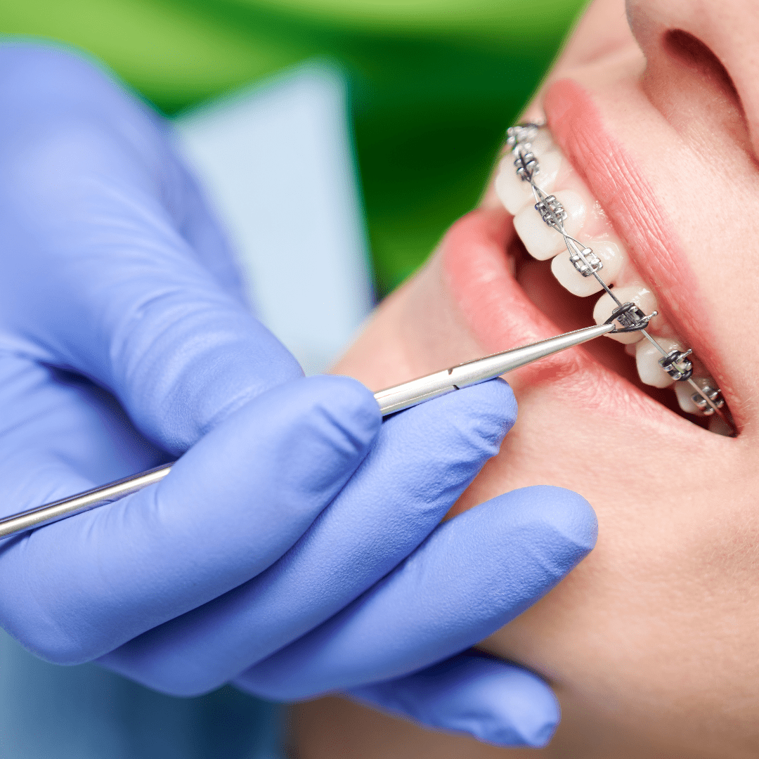 Requisitos y Preparación para Estudiar Ortodoncia: La Trayectoria hacia la Alineación Dental
